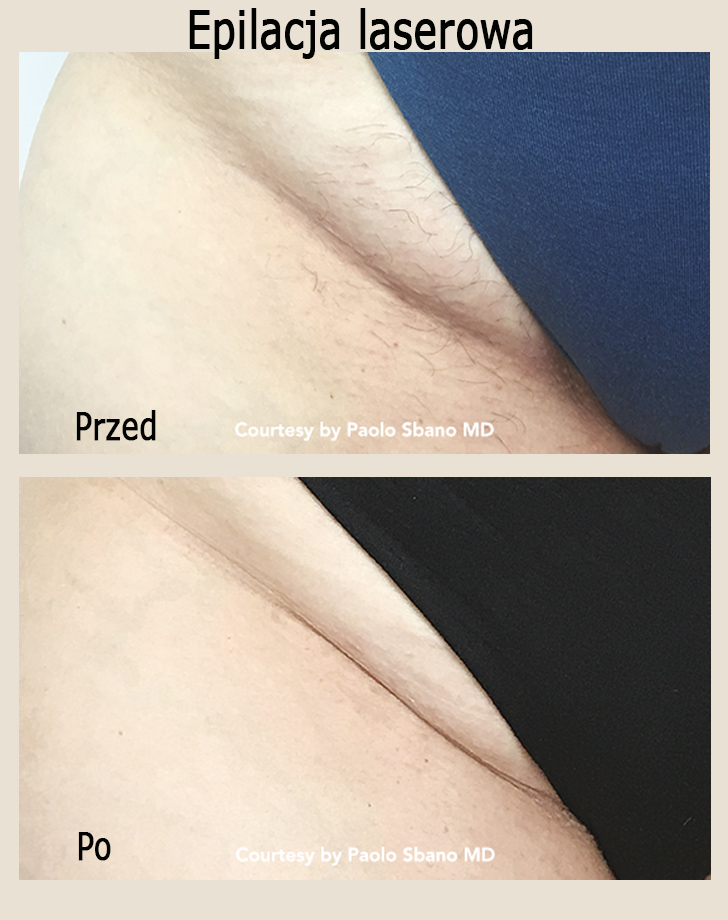 Przed