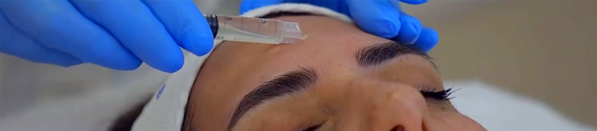 Peeling PRX-T33