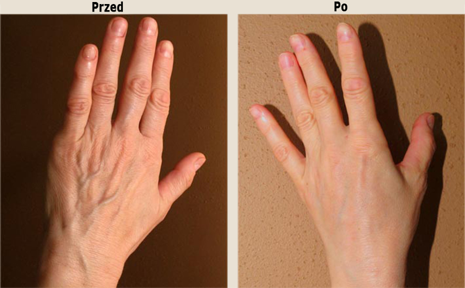 Przed