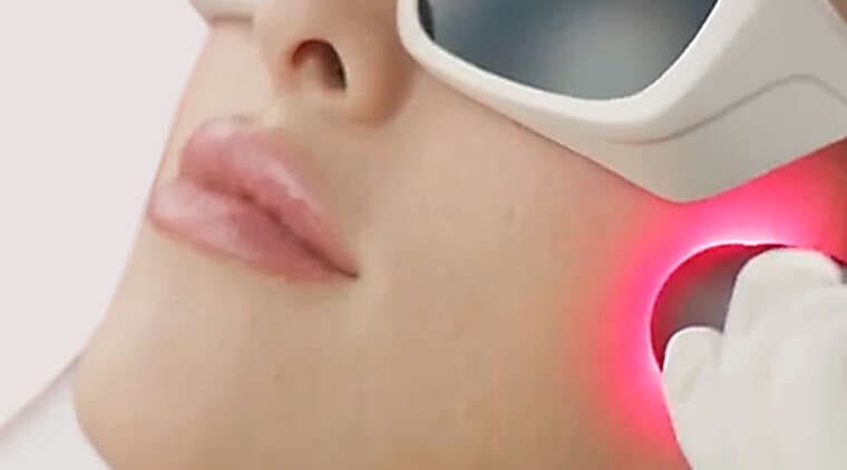 Red Touch - laser wolumetryczny